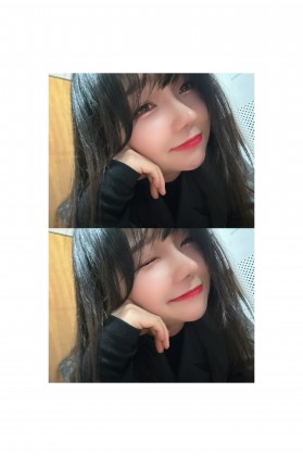 례진잉